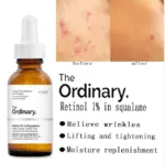 The Ordinary Retinol 1% in Squalane 30 ML - Image 3