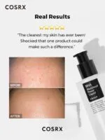 COSRX BHA Blackhead Power Liquid - Image 2